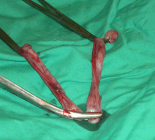 Feline reproductive tract after removal. Note the uterus as two horns forming a Y shape. The ovaries are located at the end of the arms of the Y. The cervix is at the base of the Y. Photo courtesy of Marvistavet.com.